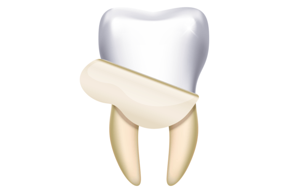 Download Tooth Whitening. Dental Hygiene Cleaning - Hygiene Collection